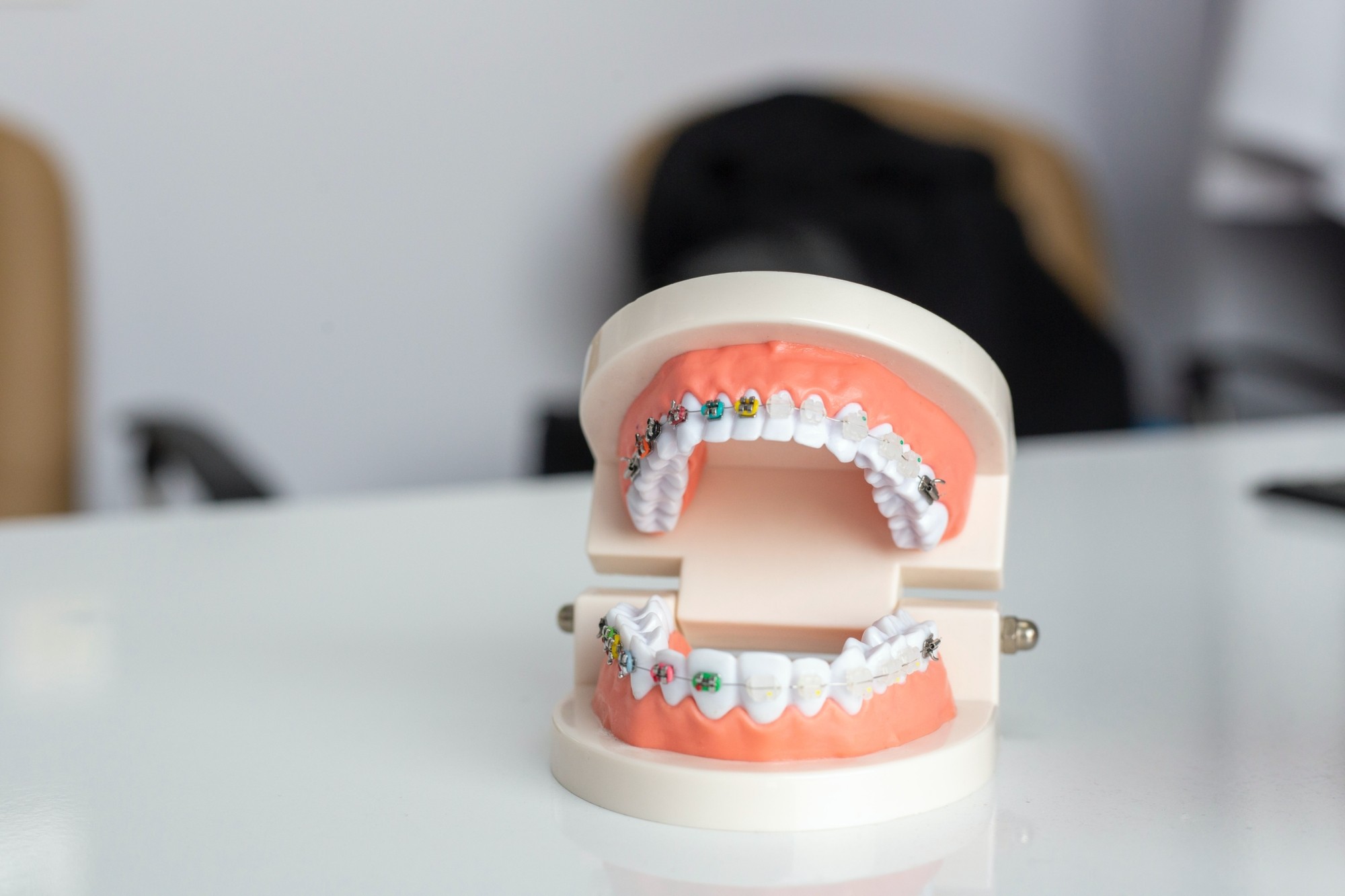 Dantų protezavimas – individualiai pritaikytas dantų atkūrimas suteiks galimybę džiaugtis puikia šypsena