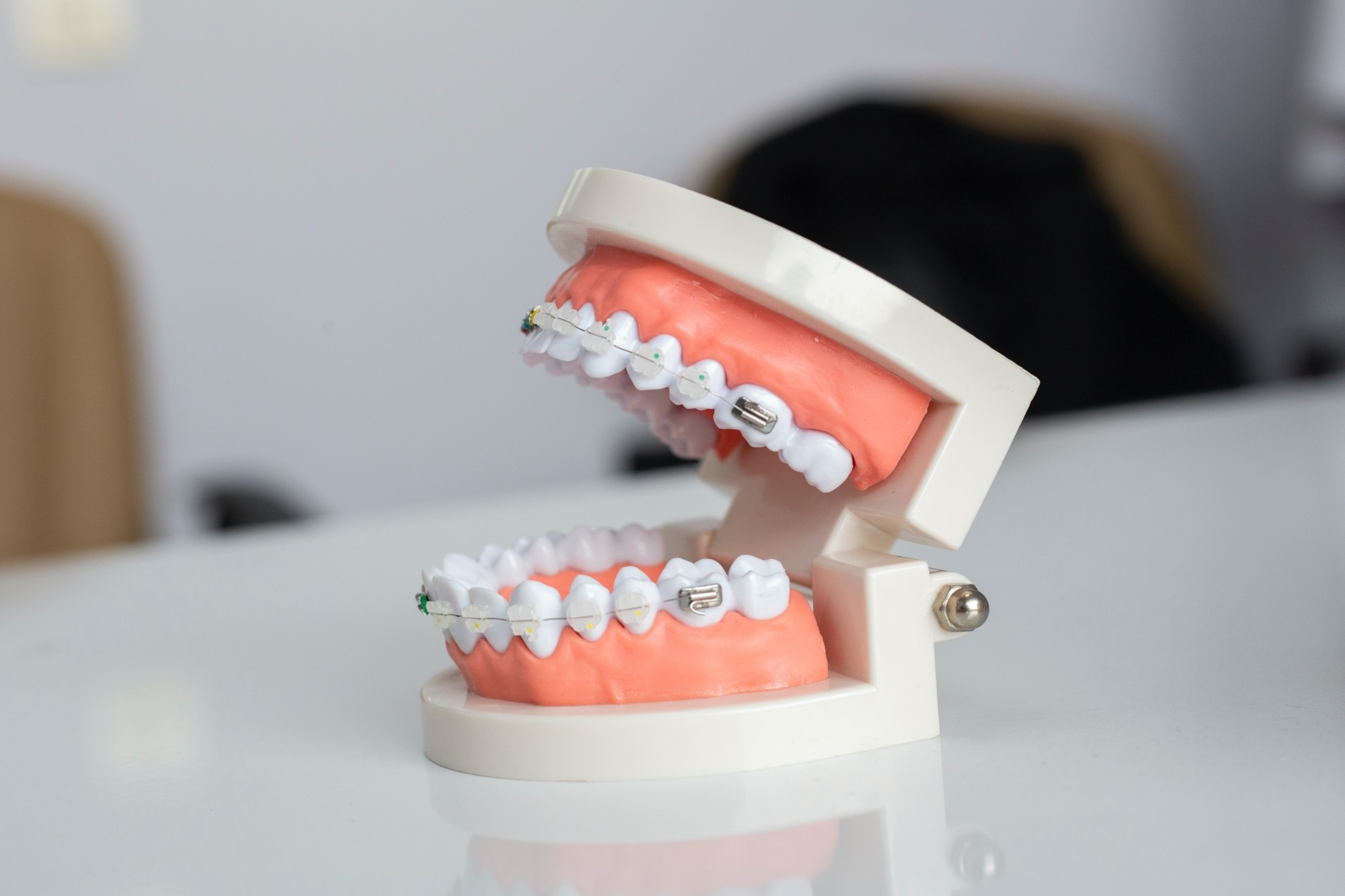 Dantų tiesinimas: populiariausi mitai apie šią procedūrą