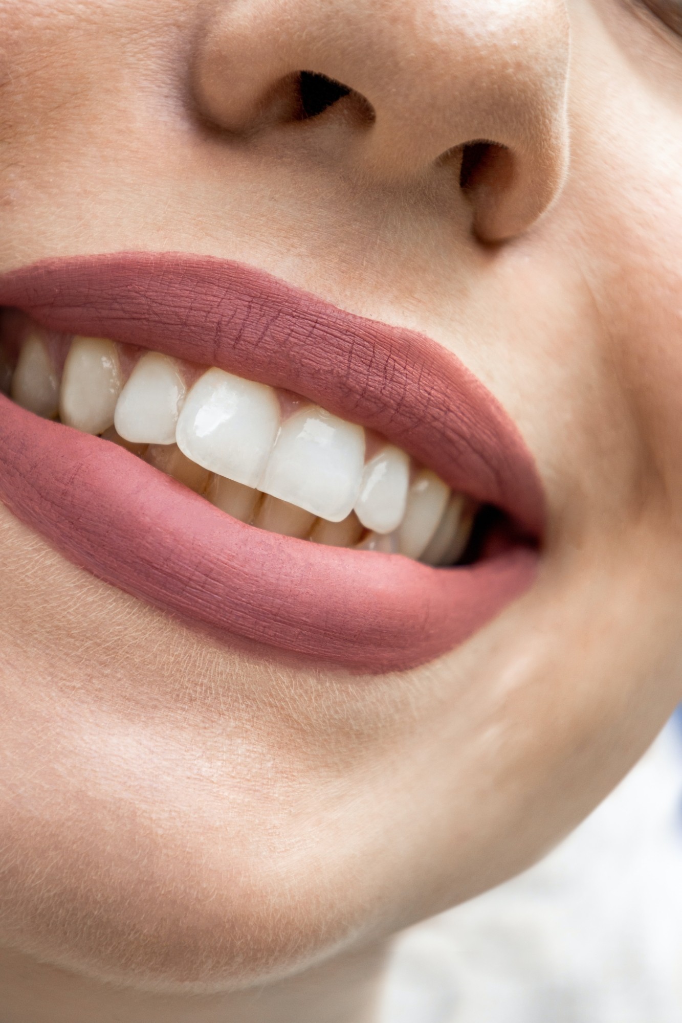 Dantų tiesinimas: privalumai, apie kuriuos turi žinoti visi pacientai