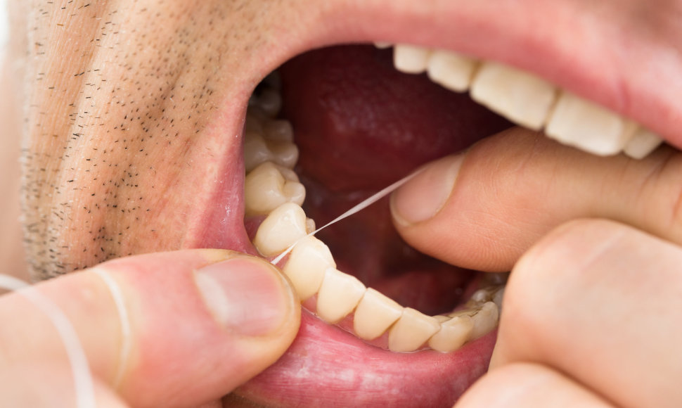 Ką būtina žinoti apie burnos higienos priemones – irigatorių, tarpdančių siūlą ar liežuvio valiklį?