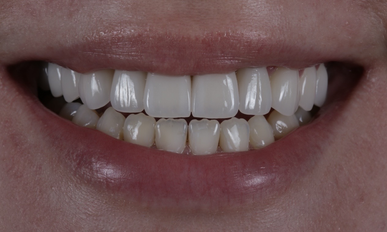 image00010
